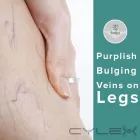 Business 1 image A-VASCULAR- VASCULAR SPECIALIST IN PERTH Vascular Surgeon in Nedlands WA