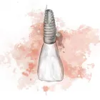 Business 5 image ARIA DENTAL Prosthodontist in Perth WA