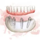 Business 6 image ARIA DENTAL Prosthodontist in Perth WA