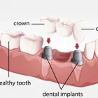 Business 7 image ARIA DENTAL Prosthodontist in Perth WA