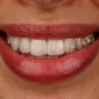 Business 1 image ASPIRED SMILES Dentist in Melbourne VIC