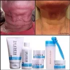Business 1 image BEAUTY STONE SKIN CARE & LASER CLINIC Skincare in Fairfield NSW