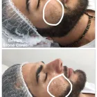 Business 4 image BEAUTY STONE SKIN CARE & LASER CLINIC Skincare in Fairfield NSW