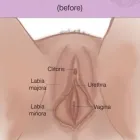 Business 1 image BODY SHAPING PERTH - LABIAPLASTY Plastic Surgery Treatments in Perth WA