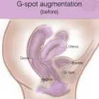 Business 3 image BODY SHAPING PERTH - LABIAPLASTY Plastic Surgery Treatments in Perth WA