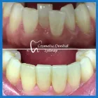 Business 3 image COSMETIC DENTIST SYDNEY Dentist in North Sydney NSW