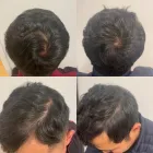 Business 1 image DELUXE CLINIC Skin Care Clinic Australia in Bentleigh East VIC