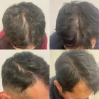Business 2 image DELUXE CLINIC Skin Care Clinic Australia in Bentleigh East VIC