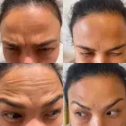 Business 4 image DELUXE CLINIC Skin Care Clinic Australia in Bentleigh East VIC