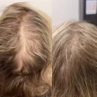 Business 5 image DELUXE CLINIC Skin Care Clinic Australia in Bentleigh East VIC