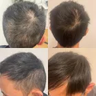 Business 6 image DELUXE CLINIC Skin Care Clinic Australia in Bentleigh East VIC