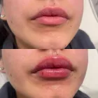 Business 8 image DELUXE CLINIC Skin Care Clinic Australia in Bentleigh East VIC