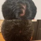 Business 9 image DELUXE CLINIC Skin Care Clinic Australia in Bentleigh East VIC