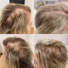 Business 10 image DELUXE CLINIC Skin Care Clinic Australia in Bentleigh East VIC