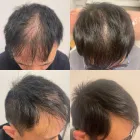 Business 11 image DELUXE CLINIC Skin Care Clinic Australia in Bentleigh East VIC
