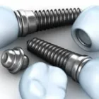 Business 7 image DENTAL IMPLANT PROFESSIONALS Tooth Implants in Melbourne VIC