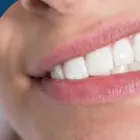 Business 5 image DENTIST CRANBOURNE NORTH Teeth Whitening in Cranbourne North VIC