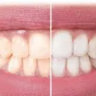 Business 3 image DENTIST HALLAM Dentist in Cranbourne VIC