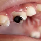 Business 1 image DENTIST LYNBROOK Dentist in Cranbourne VIC