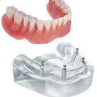 Business 4 image DENTURE CARE CLINIC Dental Technicians in Neutral Bay NSW