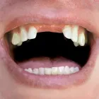Business 7 image DENTURE CARE CLINIC Dental Technicians in Neutral Bay NSW