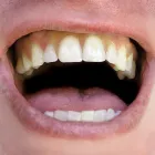 Business 8 image DENTURE CARE CLINIC Dental Technicians in Neutral Bay NSW