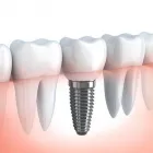 Business 2 image DR NIDHI BERERA - LEICHHARDT DENTIST Leichhardt dentists in Leichhardt NSW