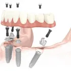 Business 3 image DR NIDHI BERERA - LEICHHARDT DENTIST Leichhardt dentists in Leichhardt NSW