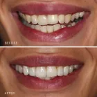 Business 12 image DR NIDHI BERERA - LEICHHARDT DENTIST Leichhardt dentists in Leichhardt NSW