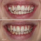 Business 13 image DR NIDHI BERERA - LEICHHARDT DENTIST Leichhardt dentists in Leichhardt NSW