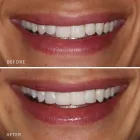 Business 14 image DR NIDHI BERERA - LEICHHARDT DENTIST Leichhardt dentists in Leichhardt NSW