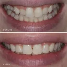 Business 15 image DR NIDHI BERERA - LEICHHARDT DENTIST Leichhardt dentists in Leichhardt NSW