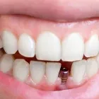 Business 2 image EVE DENTAL CENTRE Dentist in Cranbourne North VIC