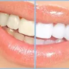 Business 1 image FIRST IMPRESSIONS LASER CLINIC Tattoo Removal in Melbourne VIC