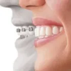 Business 5 image FREEDOM DENTAL MELBOURNE Zoom Teeth Whitening in Melbourne VIC