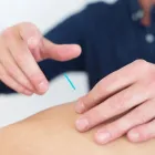 Business 3 image KOTAN CLASSICAL ACUPUNCTURE women's health Chinese Medicine in Brunswick East VIC