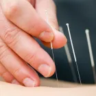 Business 1 image KYLIE STABLER ACUPUNCTURE (FERTILITY, IVF SUPPORT & WOMEN'S HEALTH) Moxibustion in Brunswick VIC