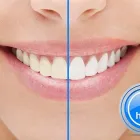 Business 3 image MELBOURNE DENTIST Titanium Dental Implants in Melbourne VIC