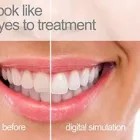 Business 5 image MELBOURNE DENTIST Titanium Dental Implants in Melbourne VIC