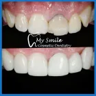 Business 4 image MY SMILE COSMETIC DENTISTRY Teeth Whitening in Sydney NSW