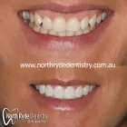 Business 1 image NORTH RYDE DENTISTRY North Ryde Dentist in Macquarie Park NSW