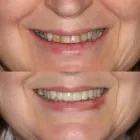 Business 3 image NORTH RYDE DENTISTRY North Ryde Dentist in Macquarie Park NSW