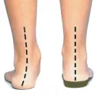 Business 1 image PODIATRY CARE MODBURY Sports Medicine in Modbury SA