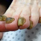 Business 4 image PODIATRY CARE MODBURY Sports Medicine in Modbury SA