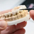 Business 2 image PORCELAIN VENEERS SYDNEY Veneer in Sydney NSW