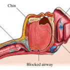 Business 4 image SOUTHERN SLEEP Sleep Disorders in Clovelly Park SA