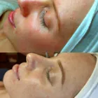 Business 8 image THE CLEAR SKIN EXPERTS Skin Treatments & Skin Clinics in Melbourne VIC