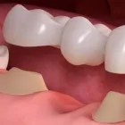 Business 2 image THE SMILE DESIGNER DENTAL STUDIO - THORNBURY DENTIST Dentist in Melbourne VIC