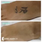 Business 5 image THINK AGAIN LASER CLINIC - BRISBANE Tattoo Removal in Fortitude Valley QLD