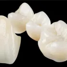 Business 2 image VTS DENTAL LAB ADELAIDE General Dentistry in Kent Town SA
